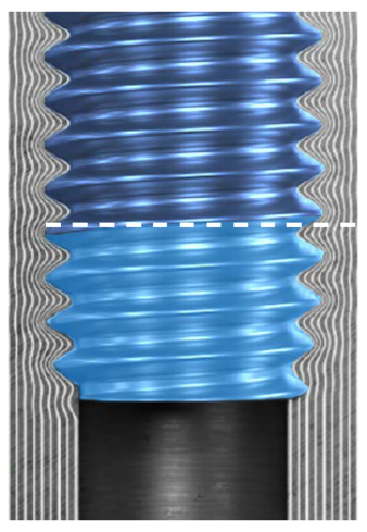Arnold-batterybox.png